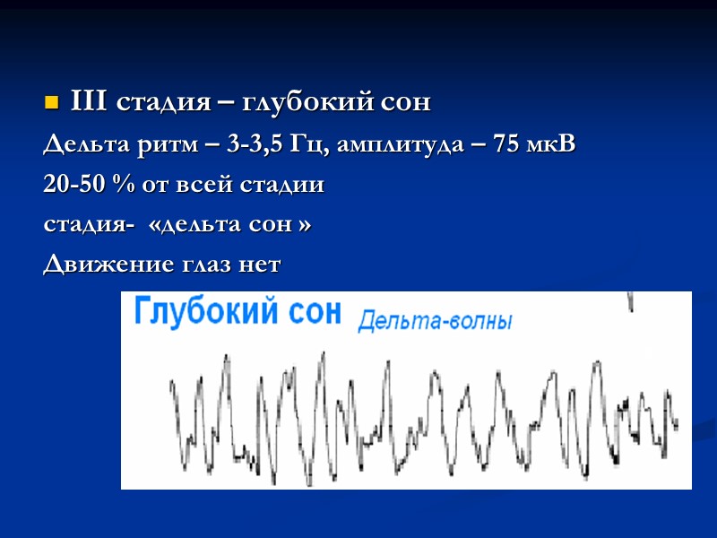 III стадия – глубокий сон  Дельта ритм – 3-3,5 Гц, амплитуда – 75